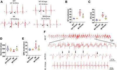 Sodium–Glucose cotransporter 2 inhibitor empagliflozin decreases ventricular arrhythmia susceptibility by alleviating electrophysiological remodeling post-myocardial-infarction in mice